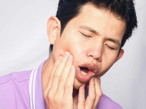 Penyebab Sakit Gigi yang Muncul Tiba Tiba